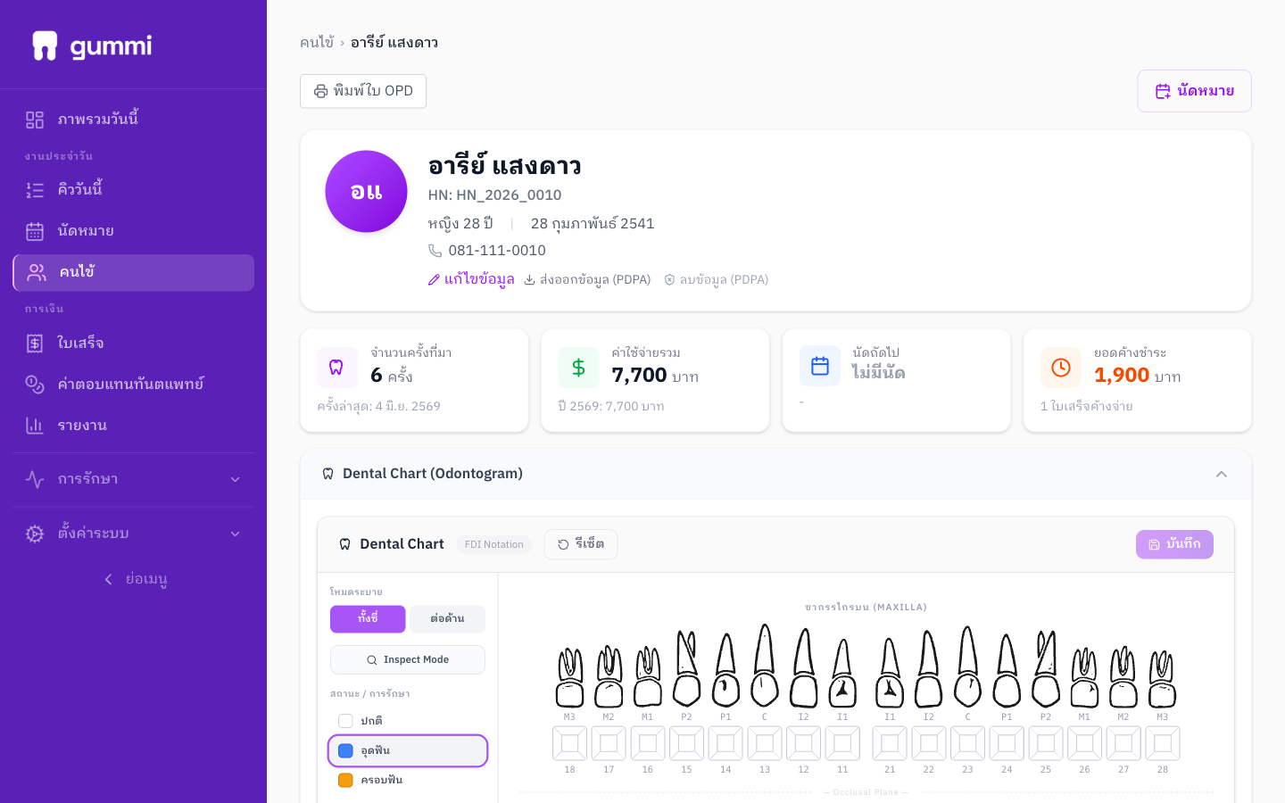 Dental Chart Interactive